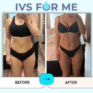 Ivs For Me